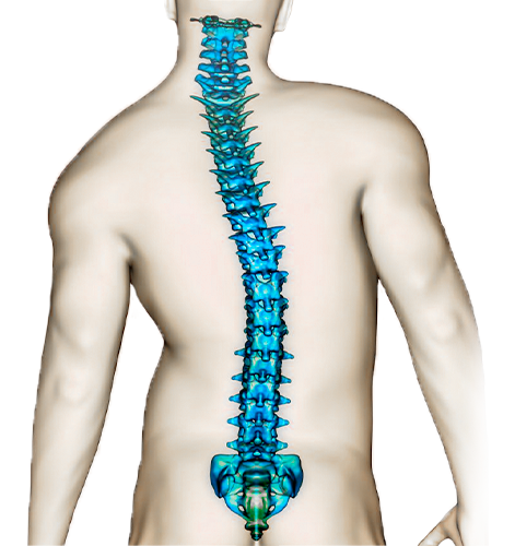 Escoliose do Adulto